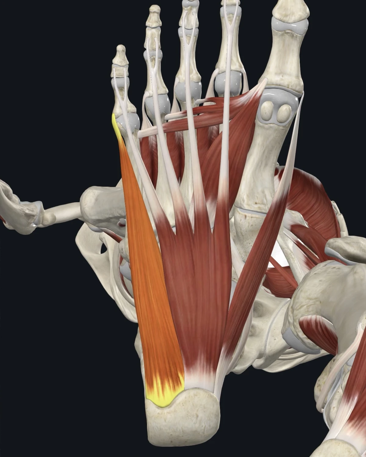 Anatomical illustration of the abductor digiti minimi on a posterior figure