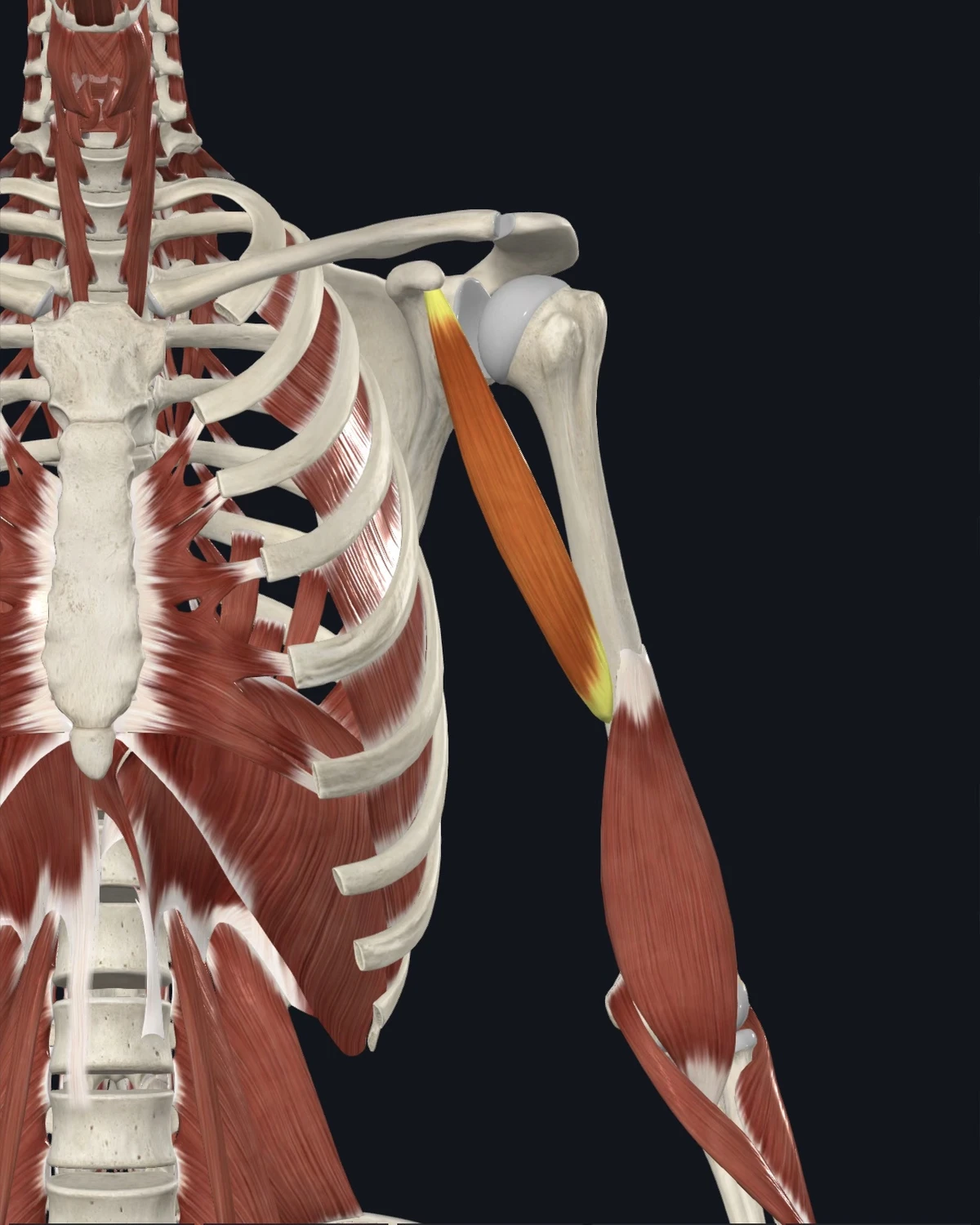 Anatomical illustration of the coracobrachialis on a posterior figure