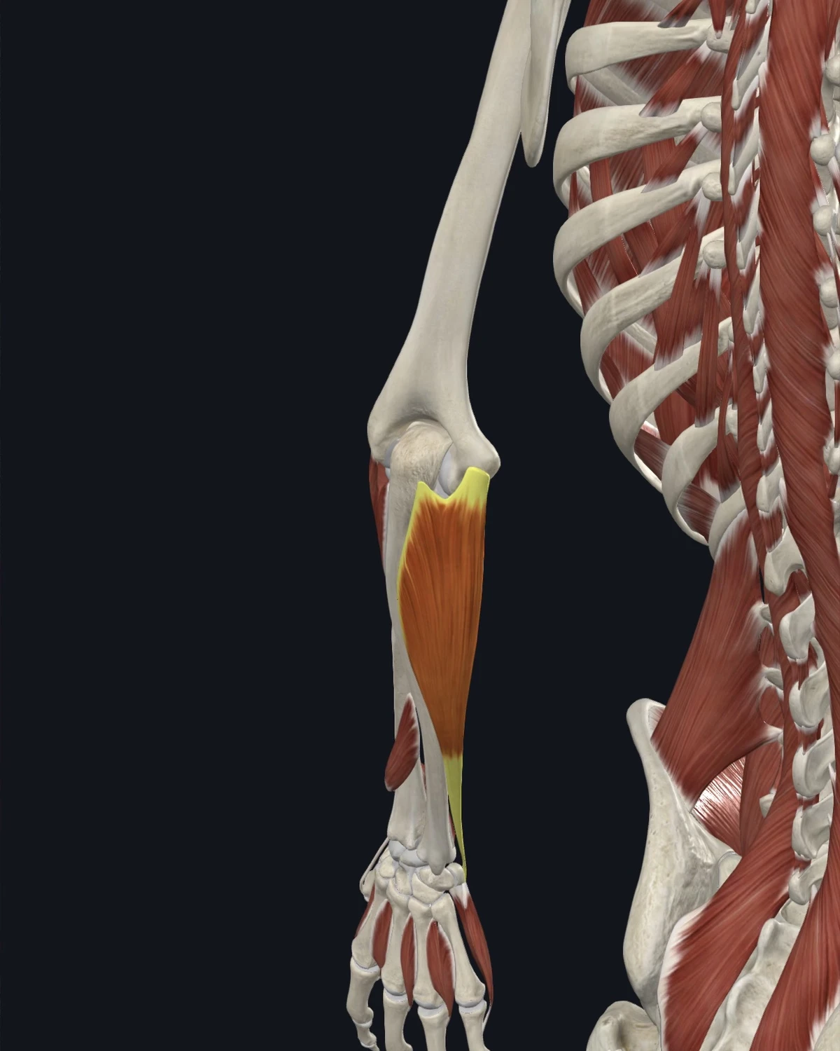 Anatomical illustration of the flexor carpi ulnaris on an anterior figure