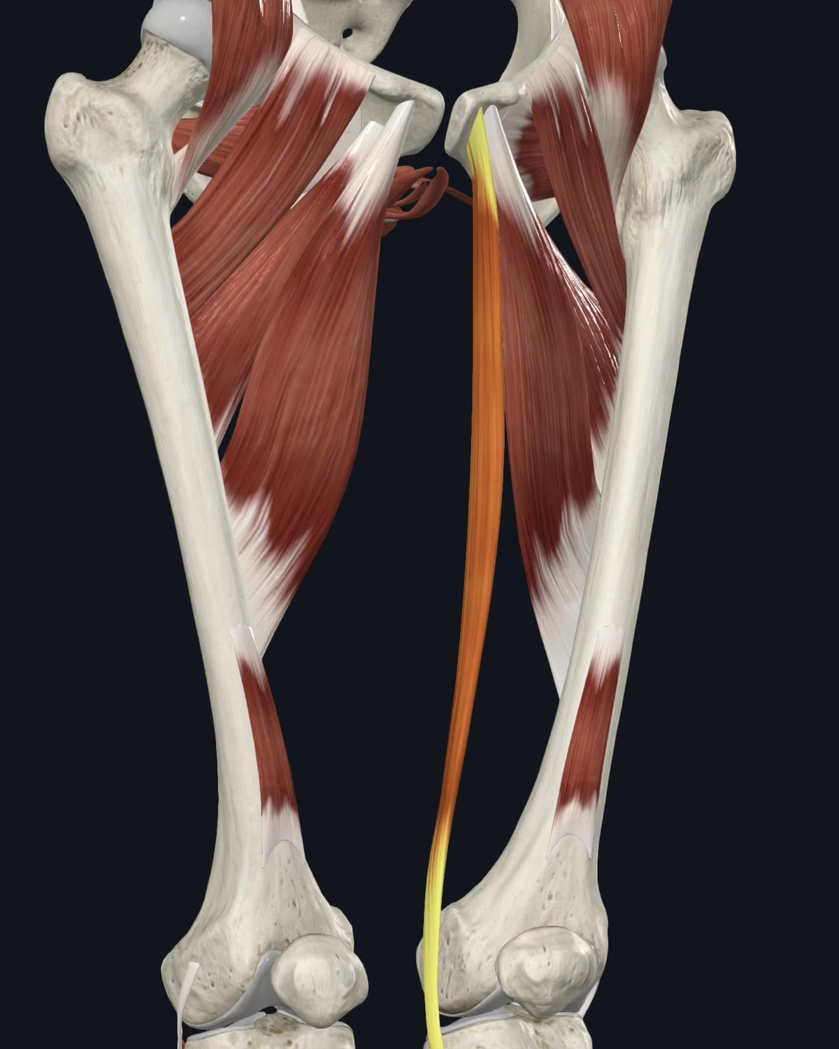 Anatomical illustration of the gracilis on an anterior figure