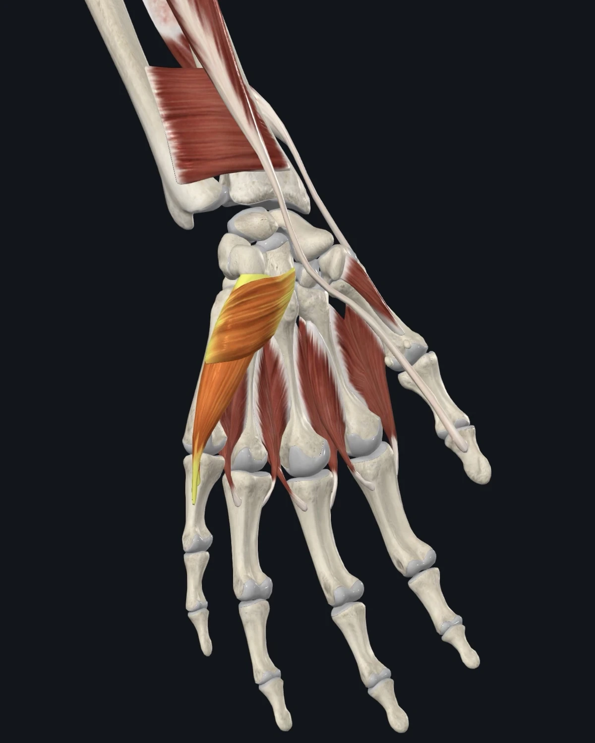 Anatomical illustration of the hypothenar muscles on an anterior figure
