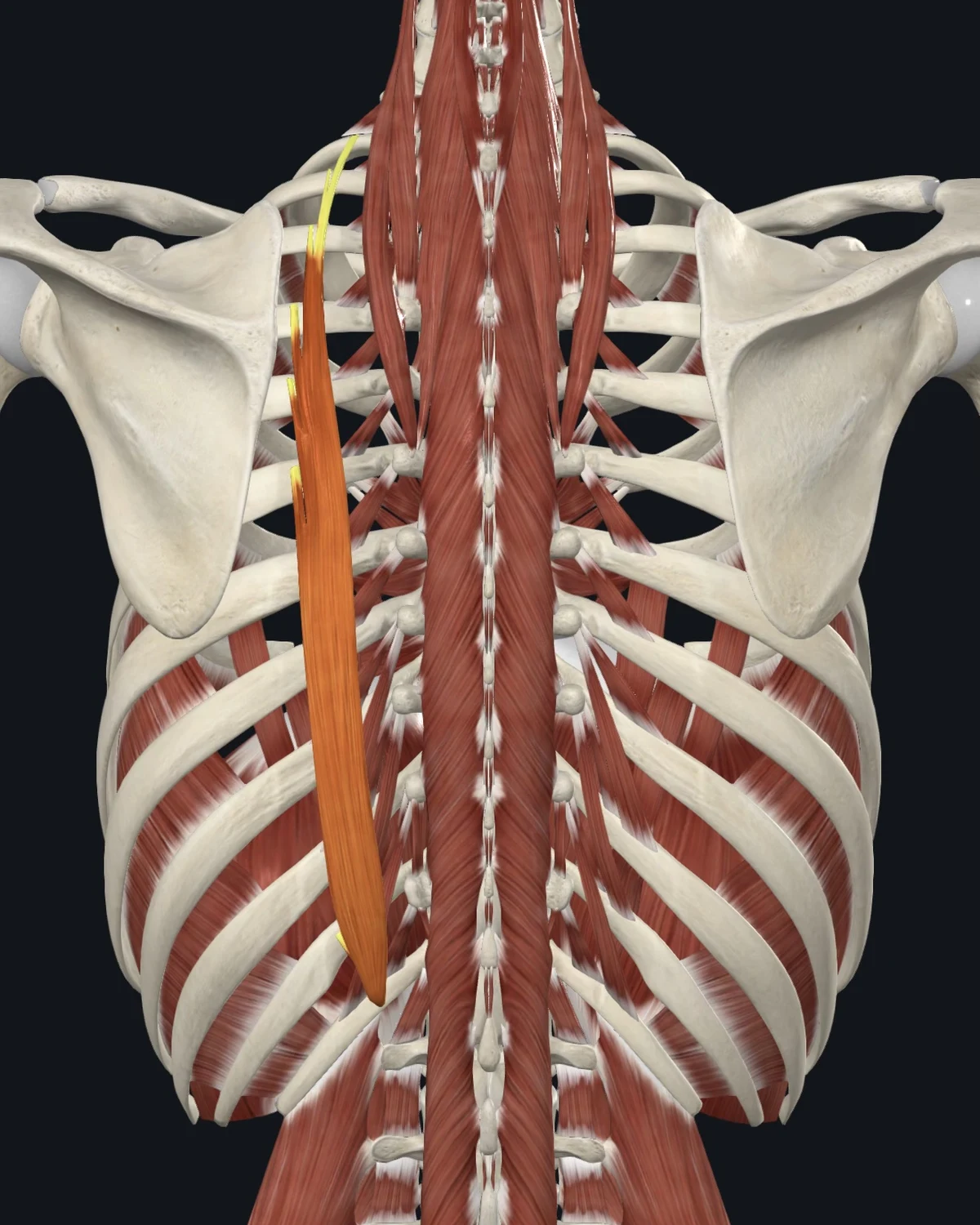 Anatomical illustration of the iliocostalis thoracis on a posterior figure