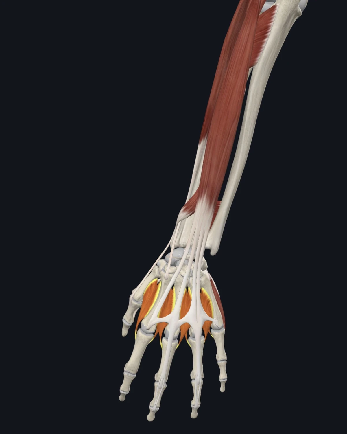 Anatomical illustration of the interossei of the hand on a posterior figure
