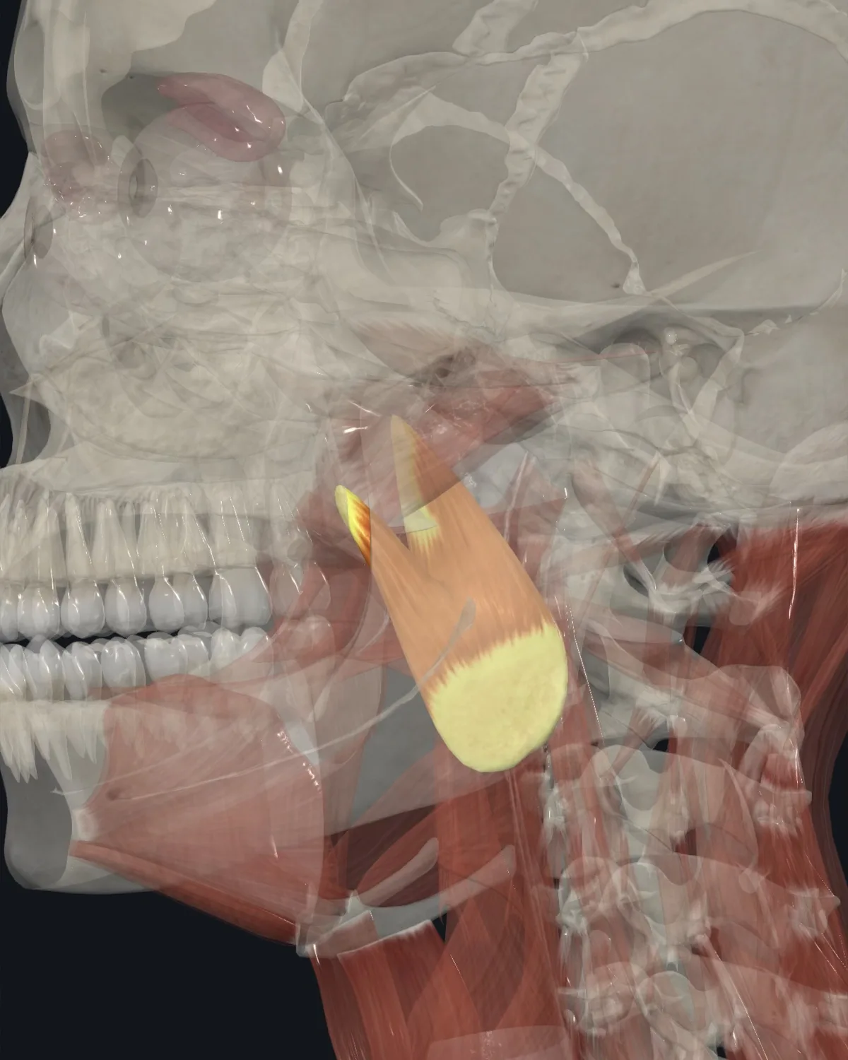 Anatomical illustration of the medial pterygoid on a lateral head view