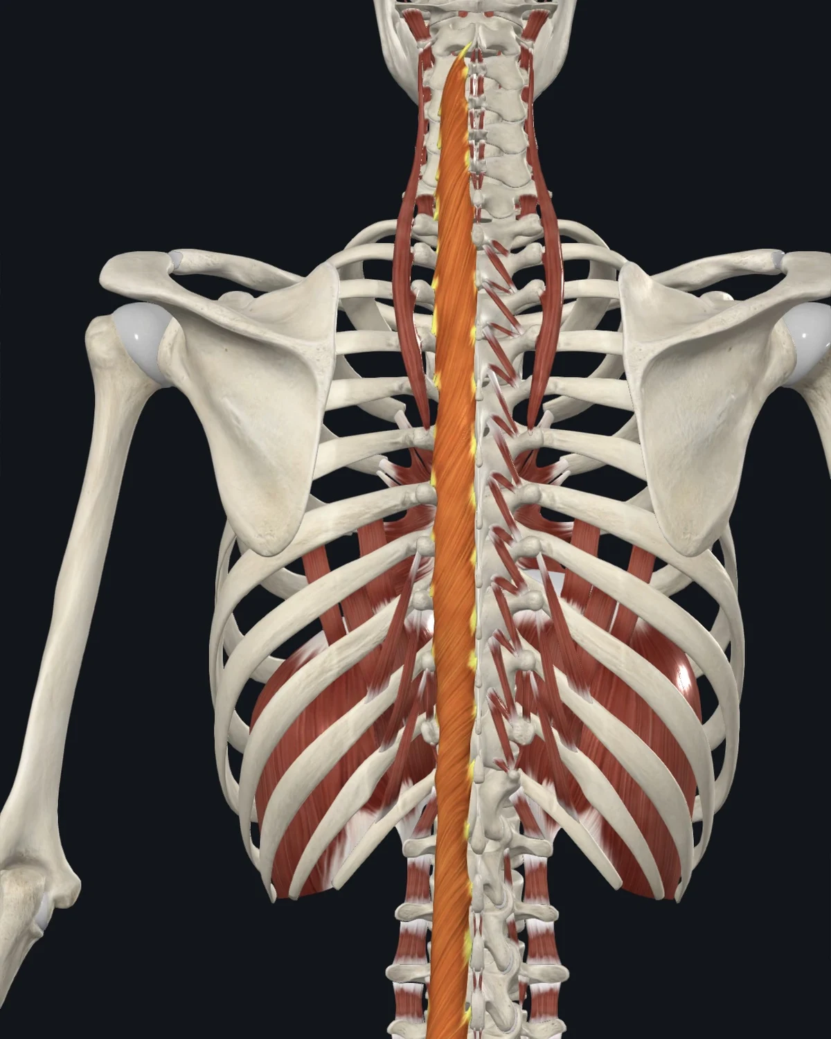 Anatomical illustration of the multifidi on a posterior figure