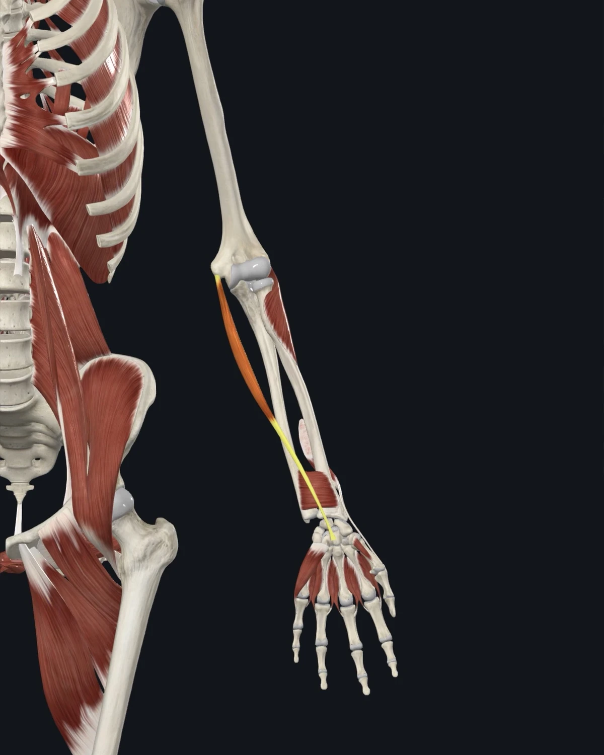 Anatomical illustration of the palmaris longus on an anterior figure