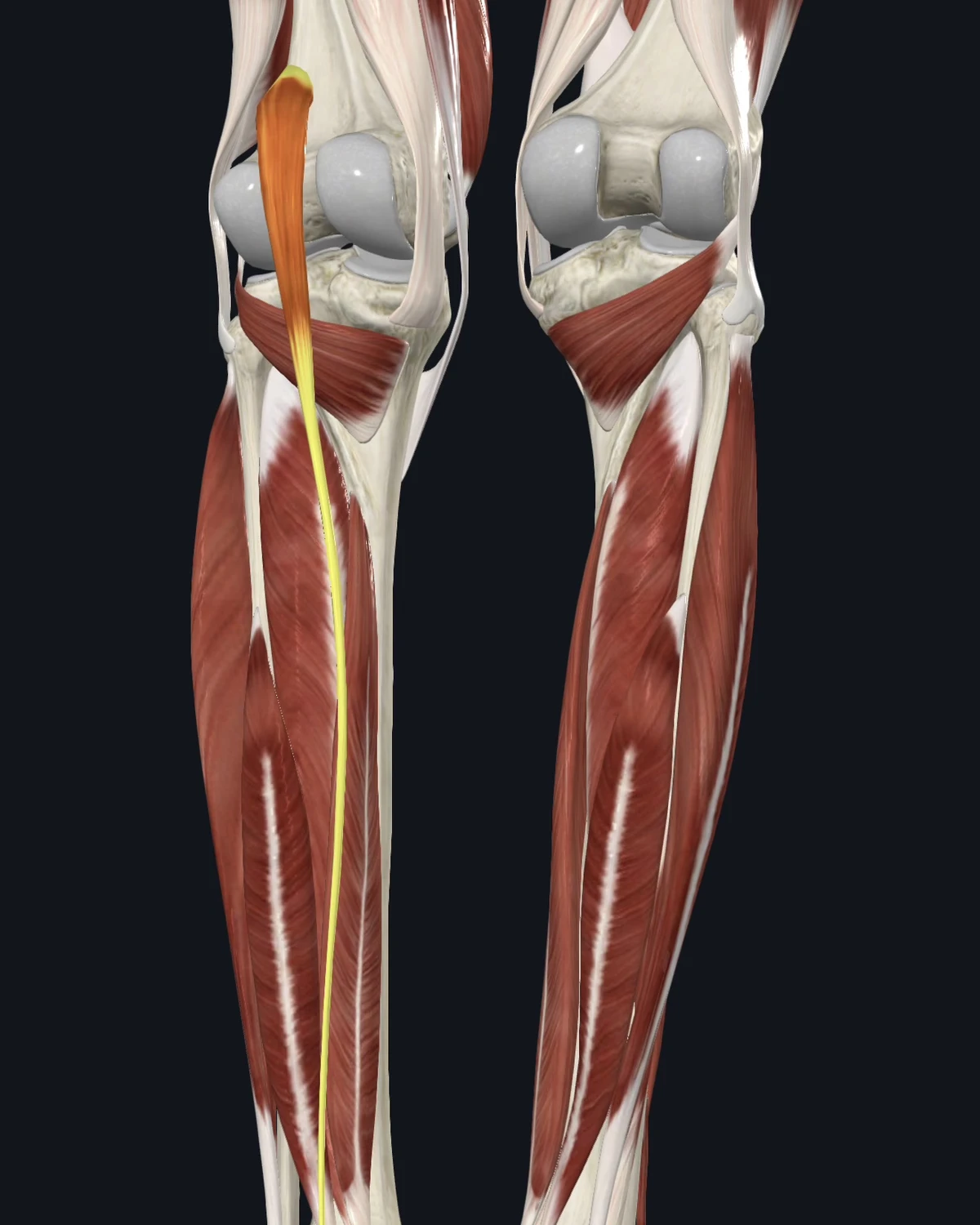 Anatomical illustration of the plantaris on a posterior figure