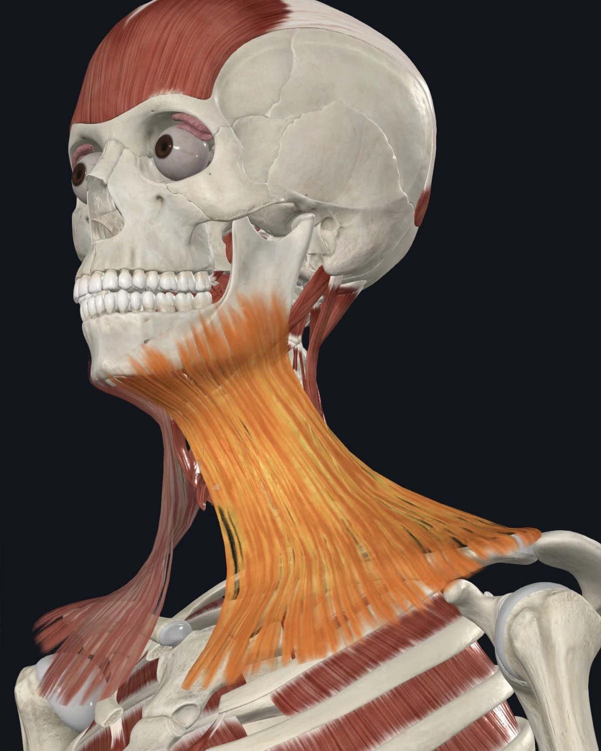 Anatomical illustration of the platysma on a lateral head view