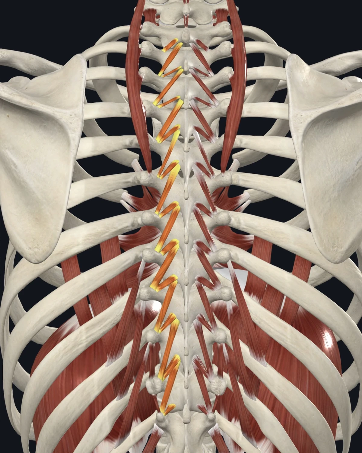 Anatomical illustration of the rotatores and deep paraspinals on a posterior figure