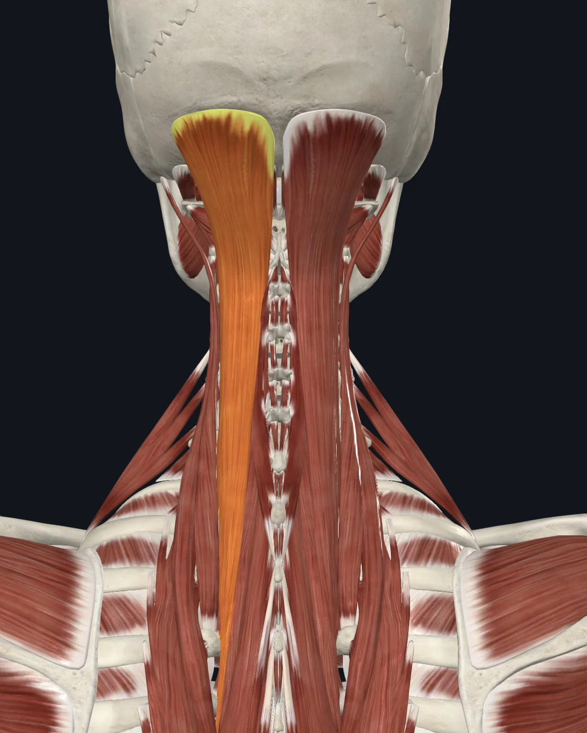 Anatomical illustration of the semispinalis capitis on a lateral head view