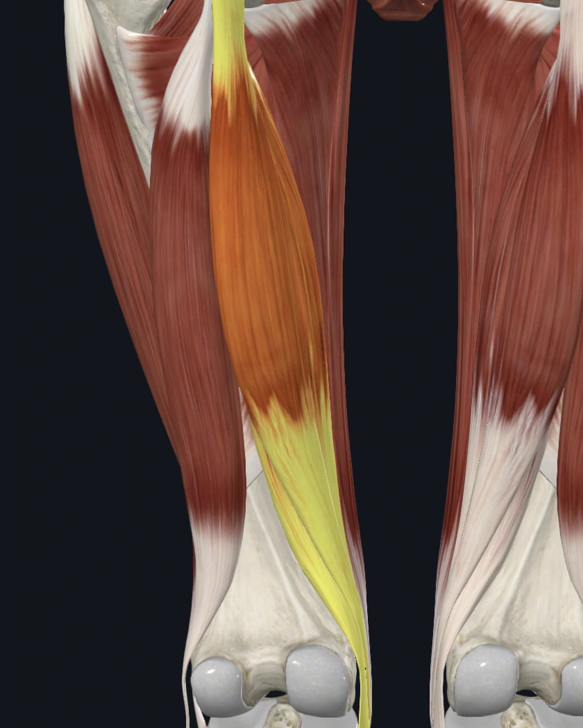 Anatomical illustration of the semitendinosus and semimembranosus on a posterior figure