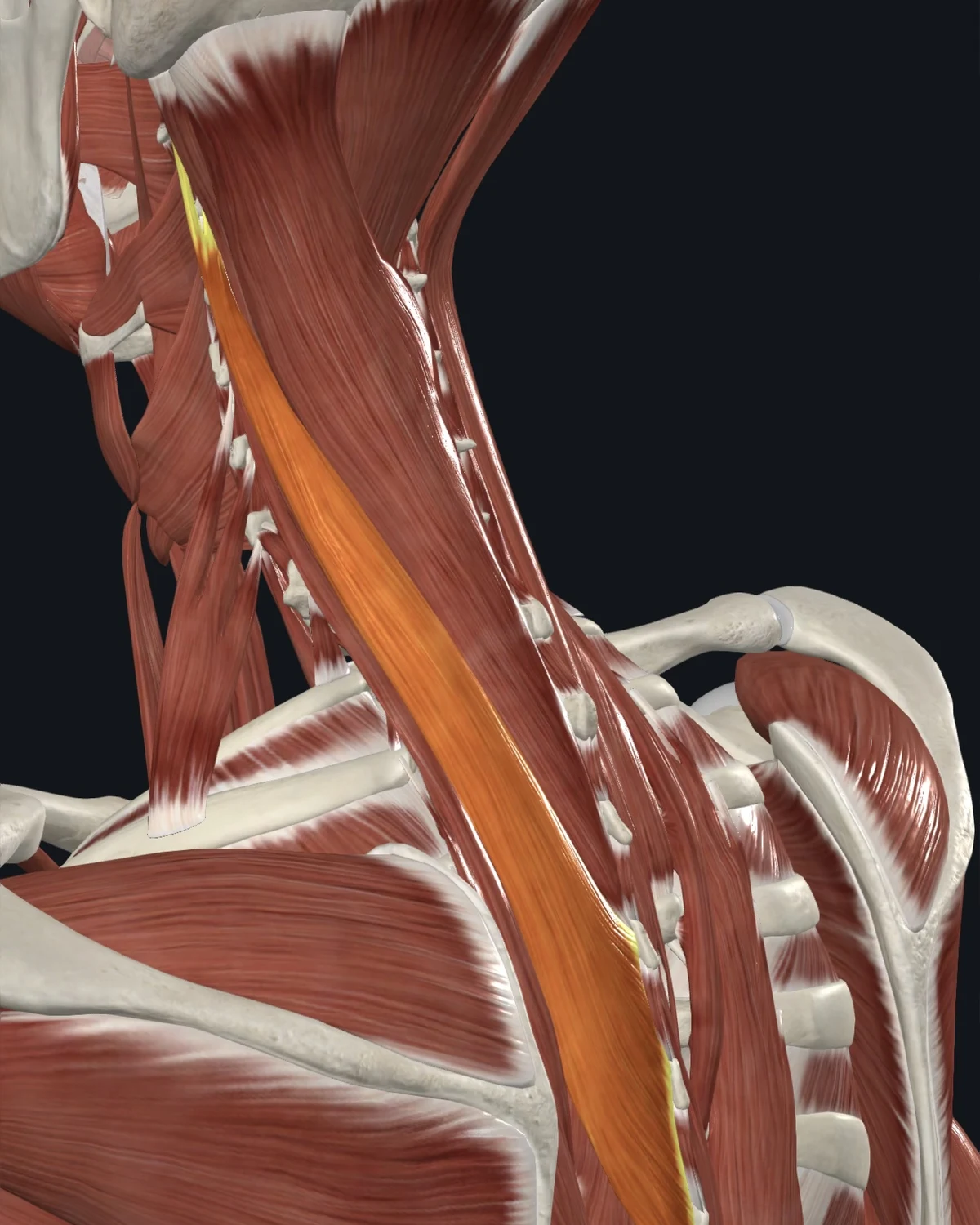 Anatomical illustration of the splenius cervicis on a lateral head view