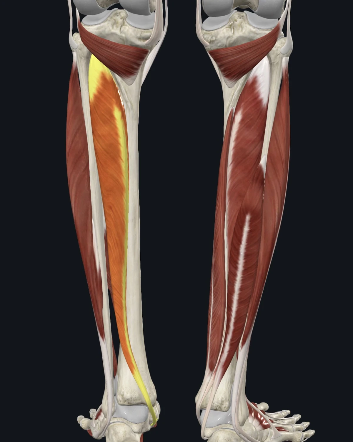 Anatomical illustration of the tibialis posterior on a posterior figure