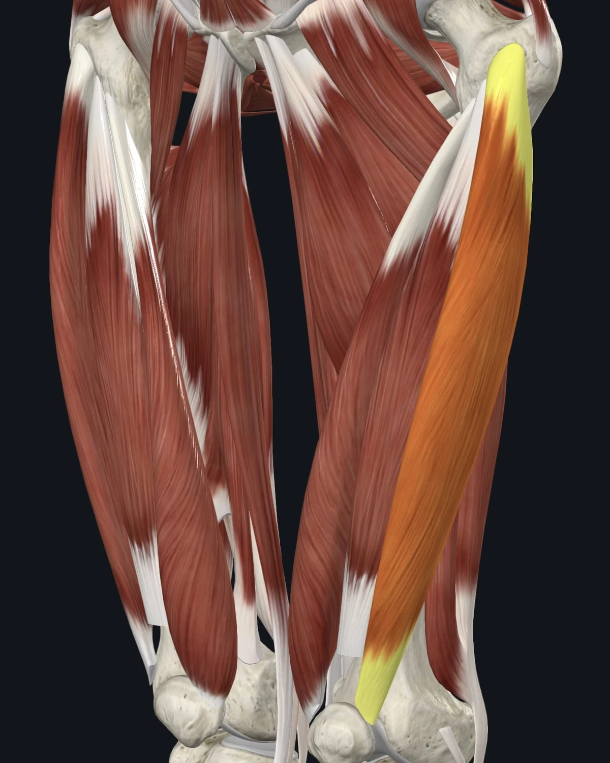 Anatomical illustration of the vastus lateralis on an anterior figure