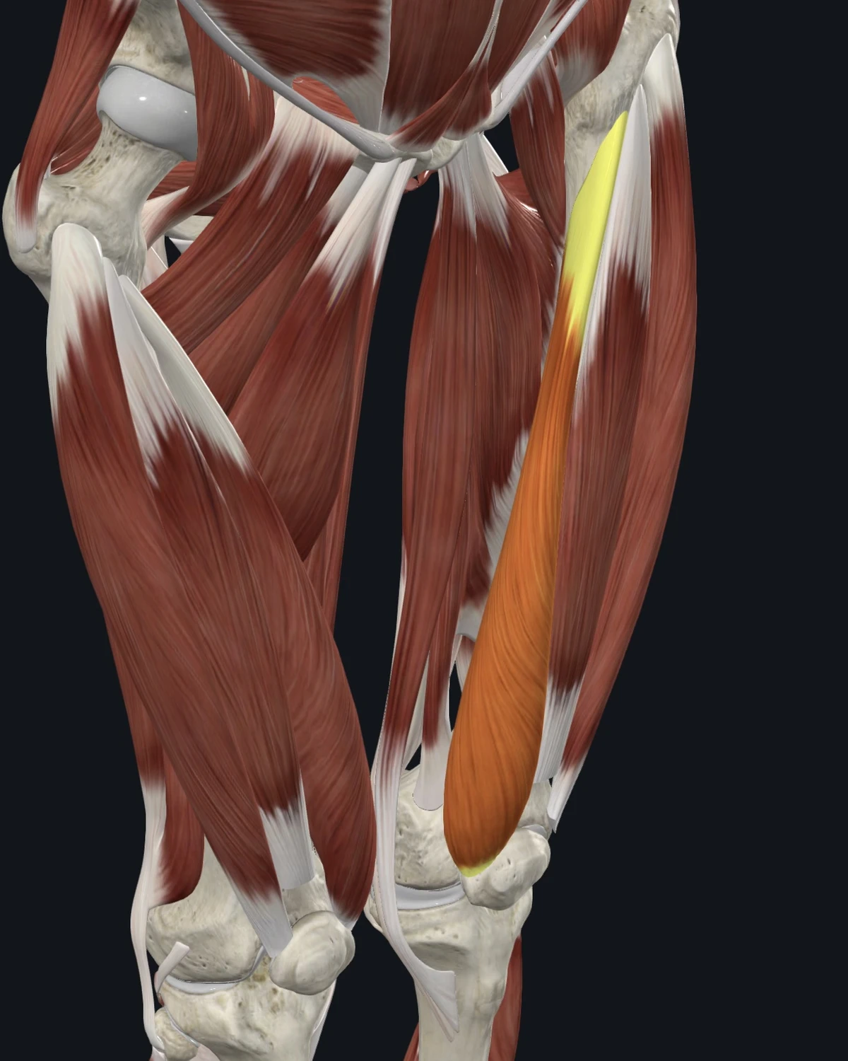 Anatomical illustration of the vastus medialis on an anterior figure